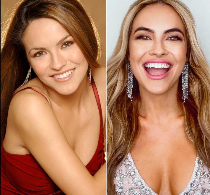 Image of Chrishell Stause before and after of Plastic Surgery